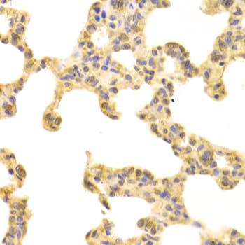 Polyclonal Rabbit anti-Human FABP4 / AP2 Antibody (IHC, IF, WB)