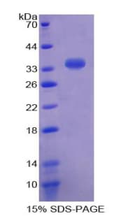 Mouse SULT1A1 / Sulfotransferase 1A1 Protein (Recombinant His-T7)
