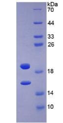 Human FGF2 / Basic FGF Protein (Recombinant His, N-Terminal)
