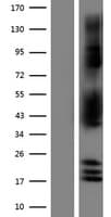 NDRG2 Protein (Over-Expression Lysate Myc-DDK (Flag))