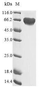 Human c-Met Protein (Recombinant 6His, C-terminus)