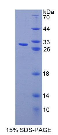 Mouse ABCF1 Protein (Recombinant His-T7, N-terminus)