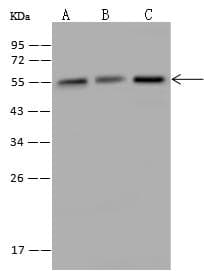 KATNA1 Antibody