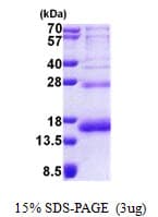 Human RPS19 / Ribosomal Protein S19 (Recombinant His)