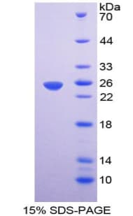 Human EMILIN1 / EMI Protein (Recombinant His-T7)