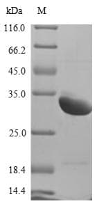 Rat USAG1 / SOSTDC1 Protein (Recombinant 10His, N-terminus + Myc, C-terminus)