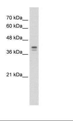 Loricrin Antibody (aa58-107, HRP)