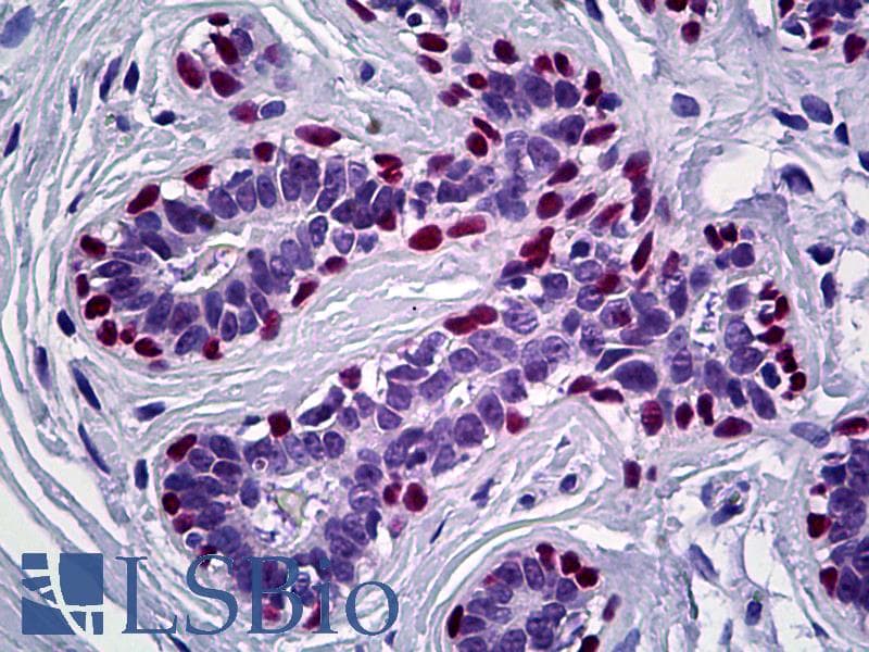 IHC-plus™ TP63 / p63 Antibody (C-Terminus)