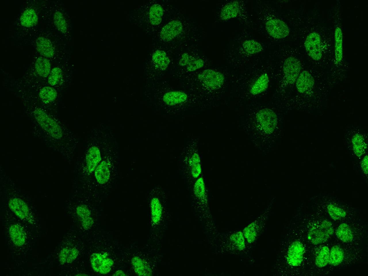 MEF2D Antibody