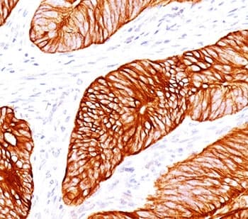 KRT8 / CK8 / Cytokeratin 8 Antibody (clone H1 + TS1, Ready-to-Use)