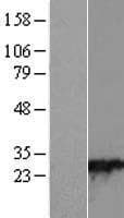 RAB28 Protein (Over-Expression Lysate Myc-DDK (Flag))