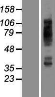 SLC2A4 / GLUT-4 Protein (Over-Expression Lysate Myc-DDK (Flag))