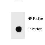 IKBKB / IKK2 / IKK Beta Antibody (phospho-Ser466)