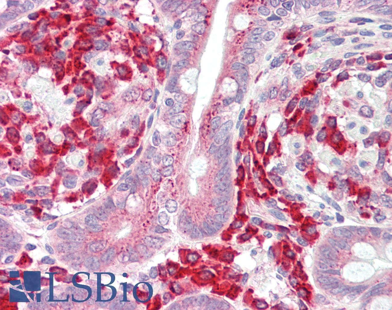 IHC-plus™ Polyclonal Rabbit anti-Human EPM2A / Laforin Antibody (IHC, IF, WB)