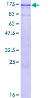 Human Band 4.1 / EPB41 Protein (Recombinant GST)