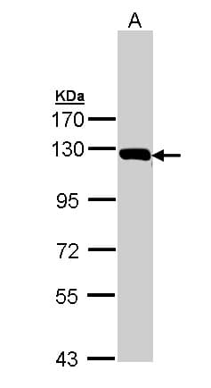 Polyclonal Rabbit anti-Human GLDC Antibody (aa442-723, IHC, WB)