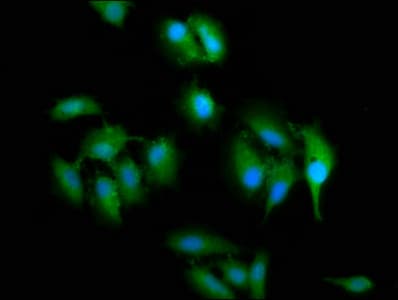 SLC2A4RG / GEF Antibody