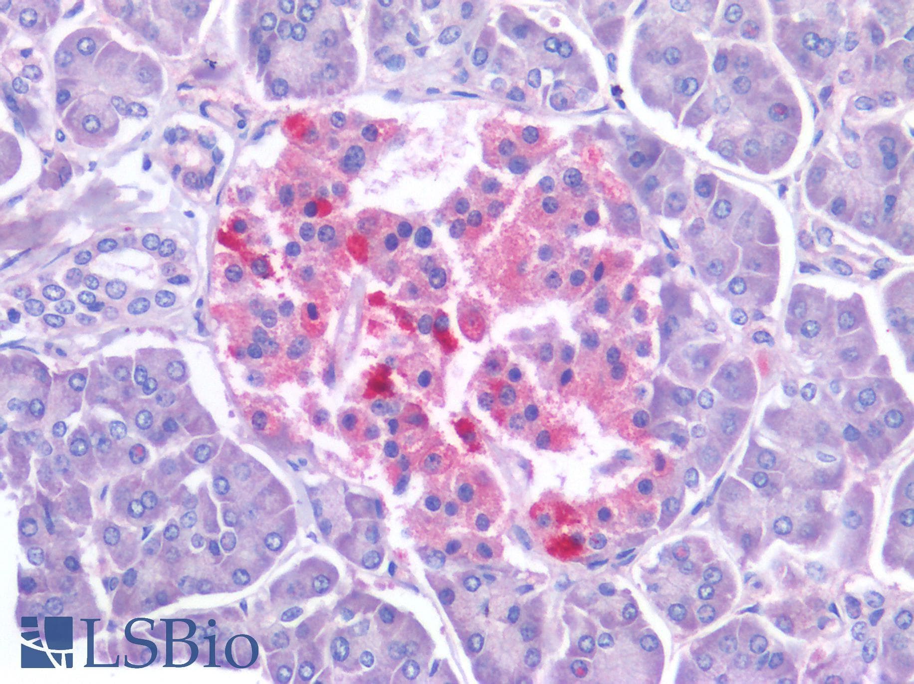 PathPlus™ Polyclonal Rabbit anti-Human NKX6-1 Antibody (IHC)
