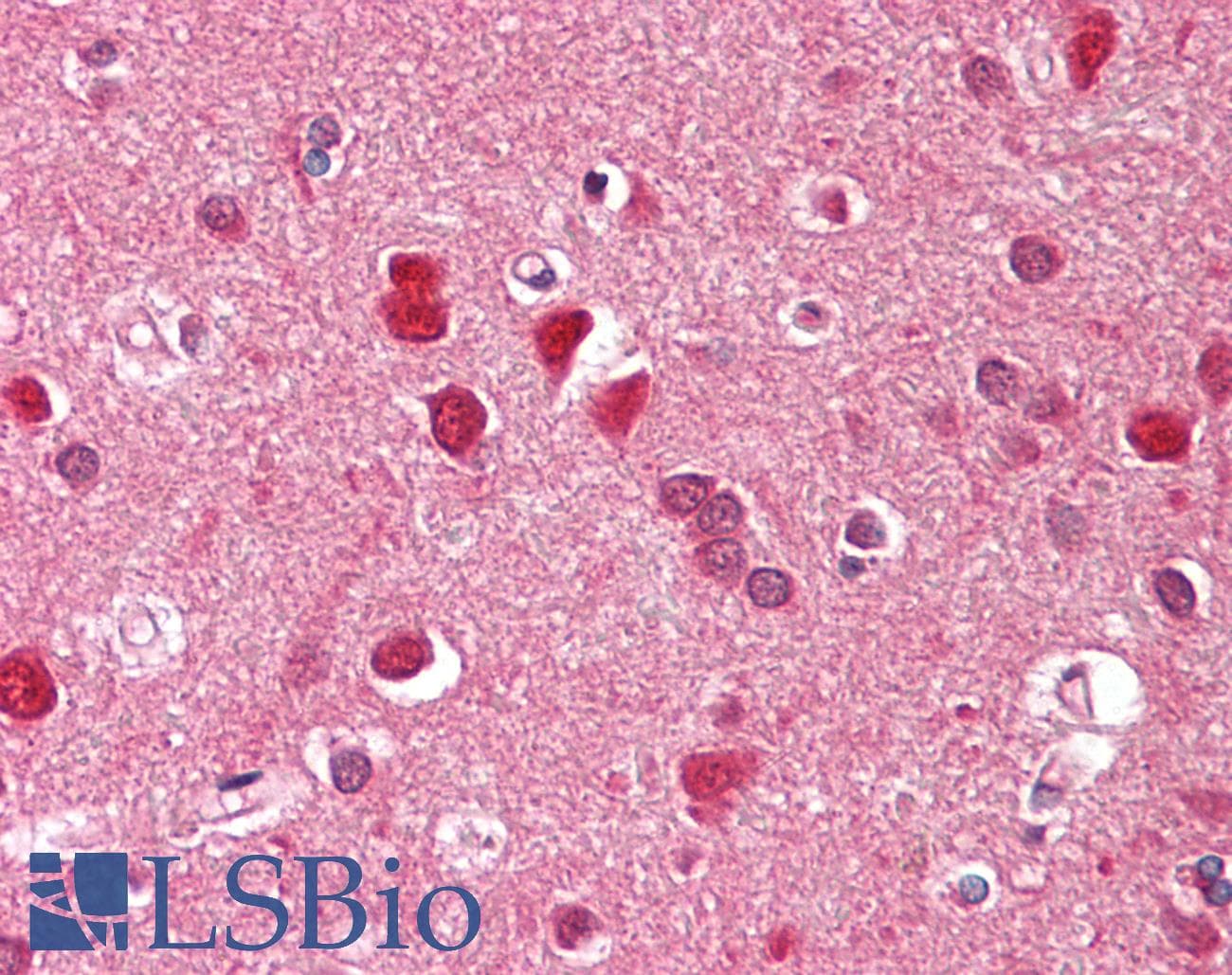 ZFYVE1 / DFCP1 Antibody (aa650-699)