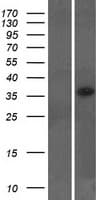 LYSMD2 Protein (Over-Expression Lysate Myc-DDK (Flag))