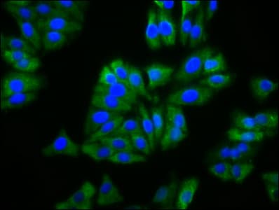 Polyclonal Rabbit anti-Human BFSP2 Antibody (IHC, IF, WB)