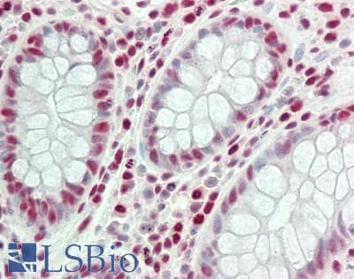 IHC-plus™ PRMT1 Antibody (aa300-C-term)