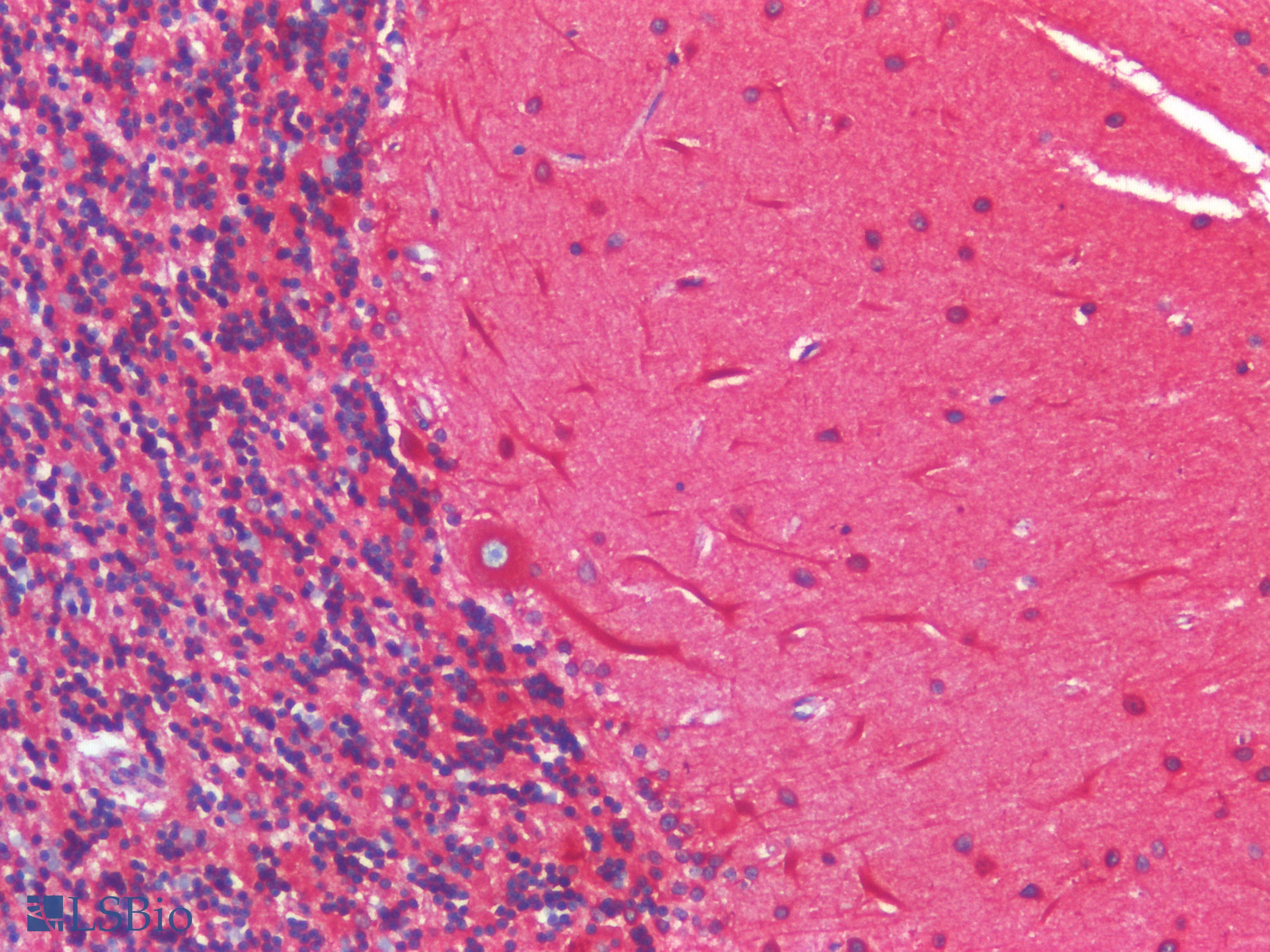 PathPlus™ CANX / Calnexin Antibody