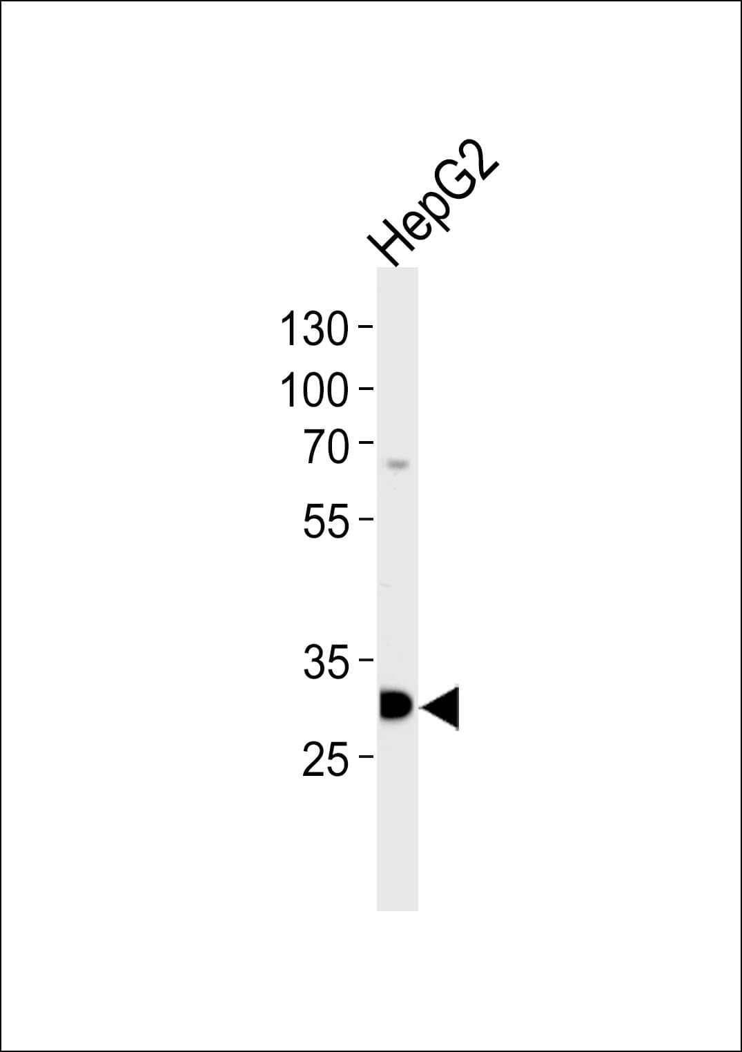 Polyclonal Rabbit anti-Human PSME2 Antibody (aa210-239, IHC, WB)