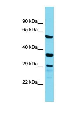 Polyclonal Rabbit anti-Human IQCC Antibody (aa191-240, WB)