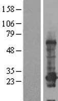 Human CCDC184 Protein (Over-Expression Lysate Myc-DDK (Flag))