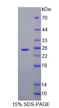 Rat FBL / FIB / Fibrillarin Protein (Recombinant His-T7, N-terminus)