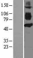 Human CD36 Protein (Over-Expression Lysate Myc-DDK (Flag))