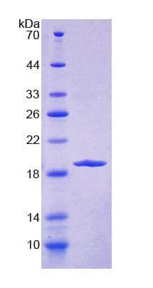 Human ERP29 Protein (Recombinant His-T7)
