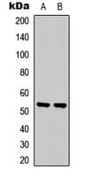 SGK1 / SGK Antibody (Internal)