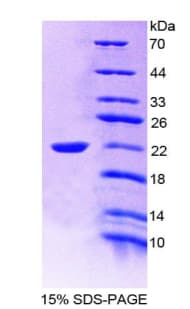 Human IL19 Protein (Recombinant His-T7)