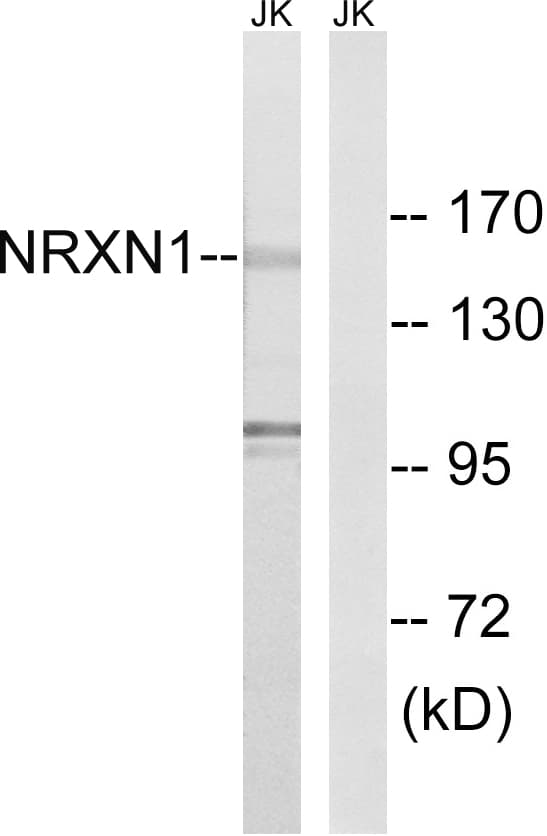 NRXN1 / Neurexin 1 Antibody (aa502-551)