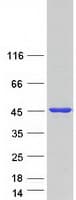 Human VPS26B Protein (Recombinant Myc-DDK (Flag))