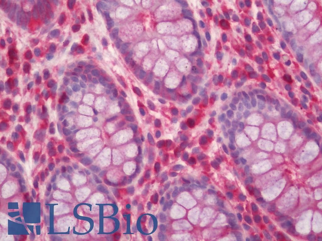 IHC-plus™ CAPN2 / Calpain 2 / M-Calpain Antibody (clone 1F4)