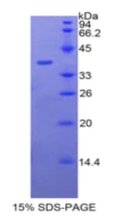 Human BPI Protein (Recombinant His-GST)
