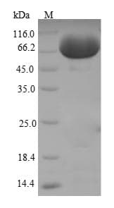Mouse Alpha Fucosidase / FUCA1 Protein (Recombinant 6His-SUMO, N-terminus)