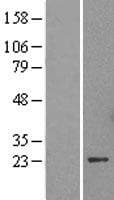 Human CBX5 / HP1 Alpha Protein (Over-Expression Lysate Myc-DDK (Flag))