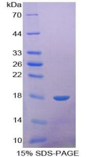 Mouse EGF Protein (Recombinant His-GST)