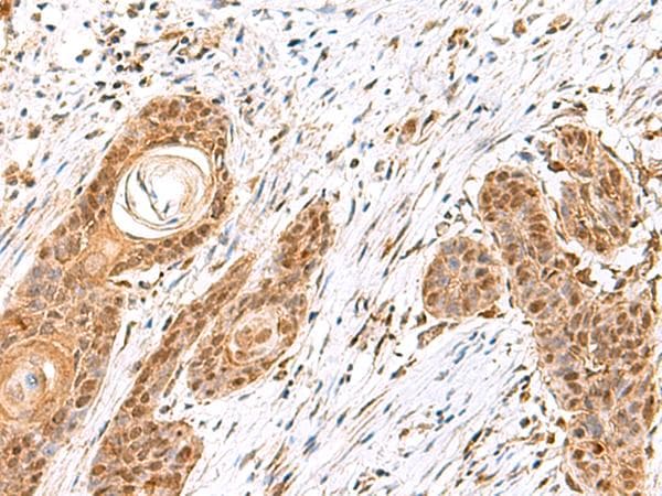 MECR Antibody