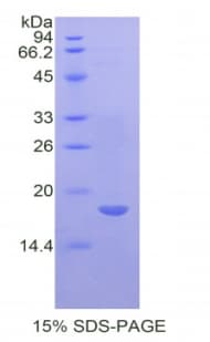 Human IL17RA Protein (Recombinant His)