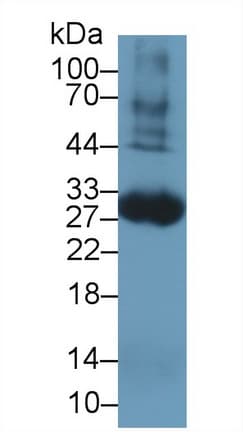 F3 / CD142 / Tissue factor Antibody (aa30-252)
