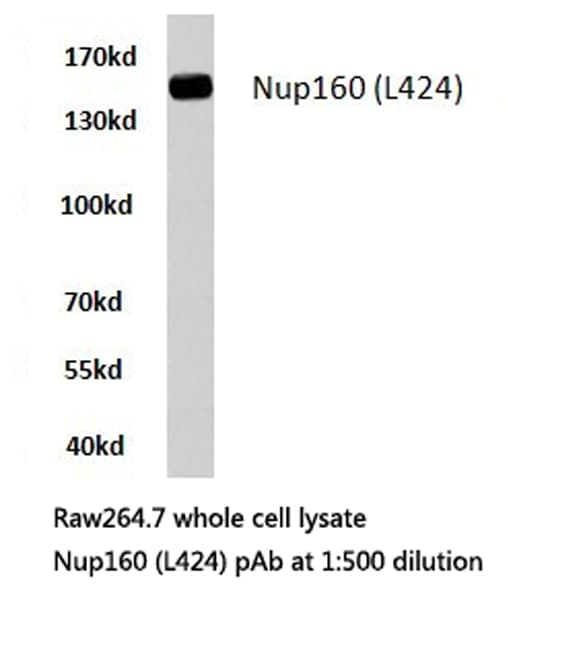 NUP160 Antibody (Leu424)