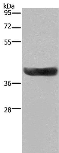 HSD17B2 Antibody
