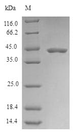 Human PLD6 / Phospholipase D6 Protein (Recombinant 6His-SUMO, N-terminus)