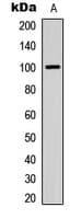 Polyclonal Rabbit anti-Human ITIH3 Antibody (Internal, WB)
