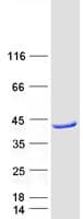 Human ACAD8 Protein (Recombinant Myc-DDK (Flag))